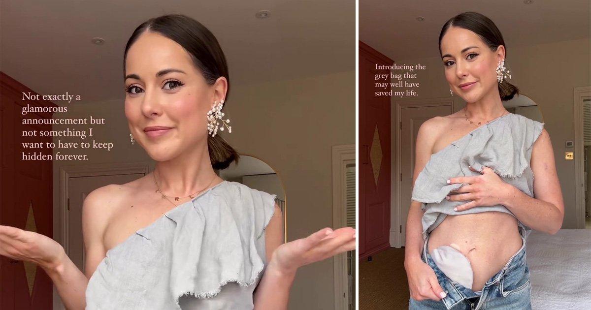 Louise Thompson ‘proud’ to reveal stoma bag after major health battle [Video]