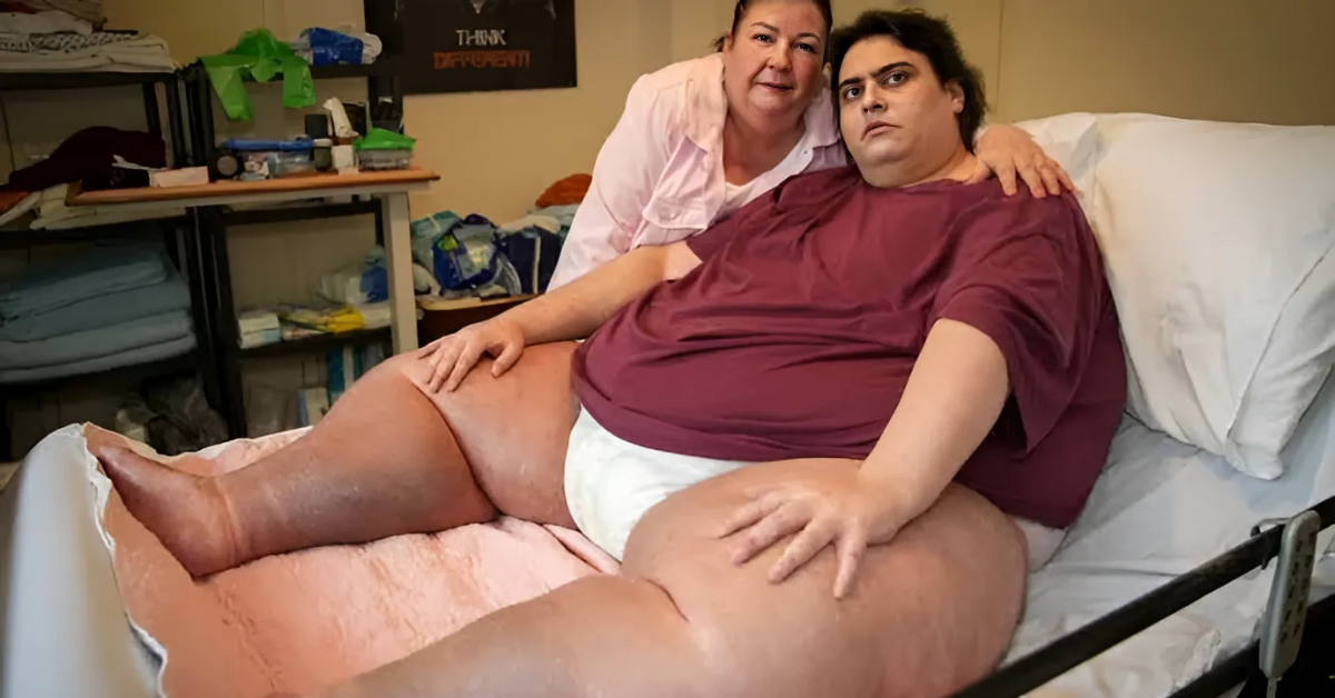 Britain’s Heaviest Man, Jason Holton, Dies at 33 from Organ Failure [Video]