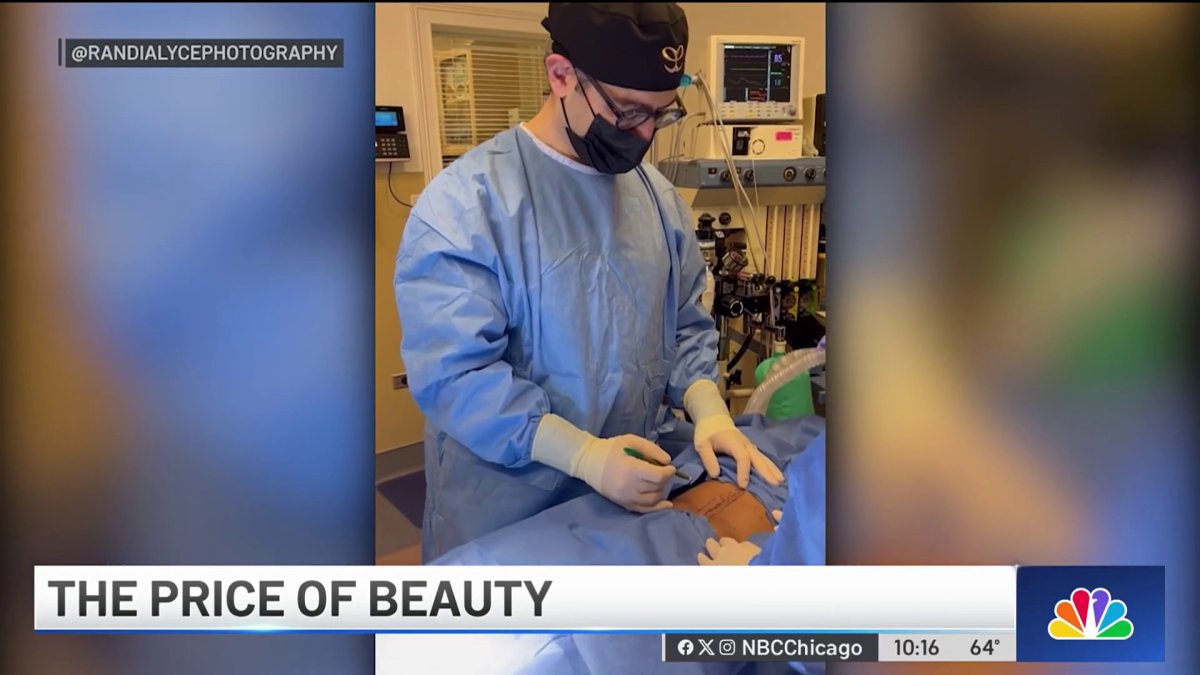 Benefits, risks both at play with trendy plastic surgeries  NBC Chicago [Video]
