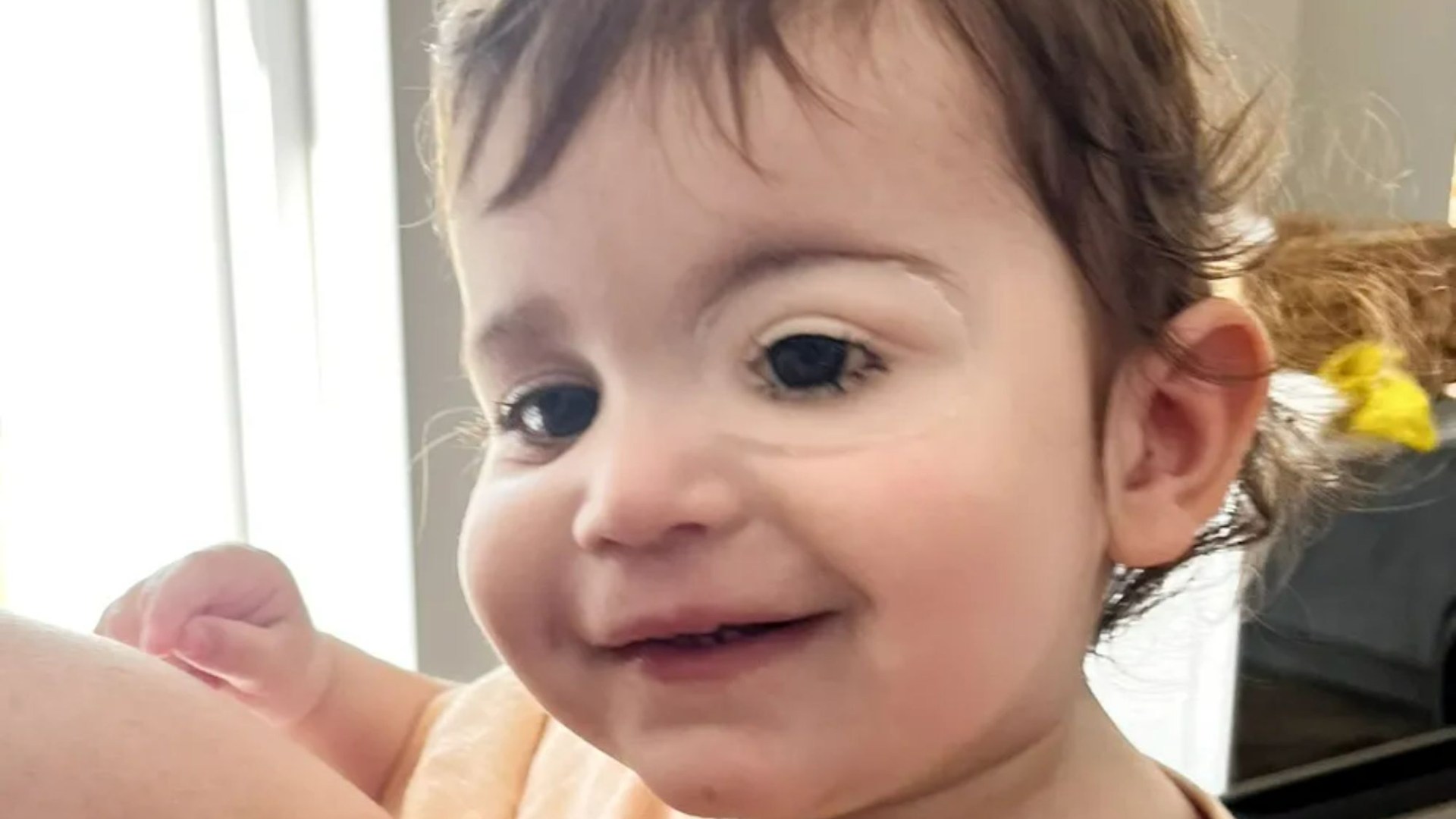 Toddler whose bloodshot eye turned out to be aggressive cancer gets ‘amazing’ prosthetic eye after losing her sight [Video]