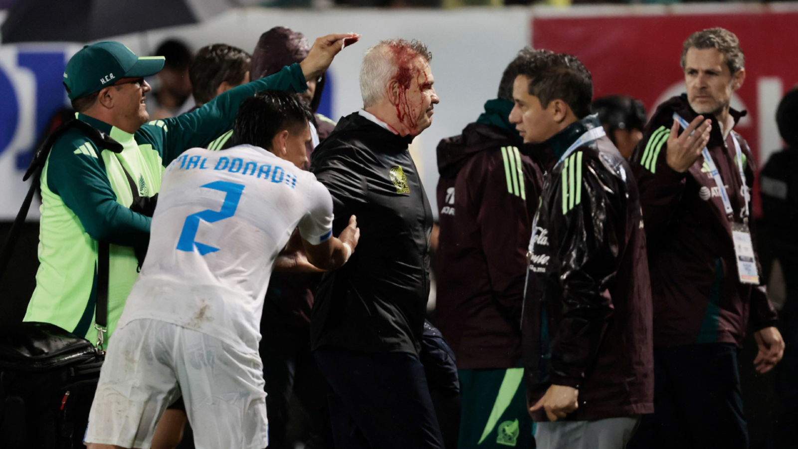 Mexico soccer manager Javier Aguirre struck by can thrown onto the pitch from stands, left with bloodied head [Video]