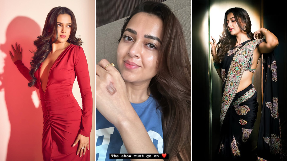 Tejasswi Prakash Sustains Burn Injury on the Set of Celebrity MasterChef: Tips To Prevent Burn Injuries In The Kitchen<!-- --> [Video]